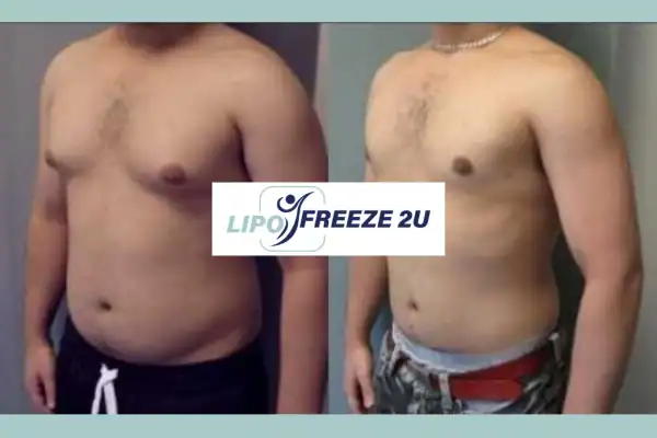 How Long Does It Take to See Results Beaconsfield?