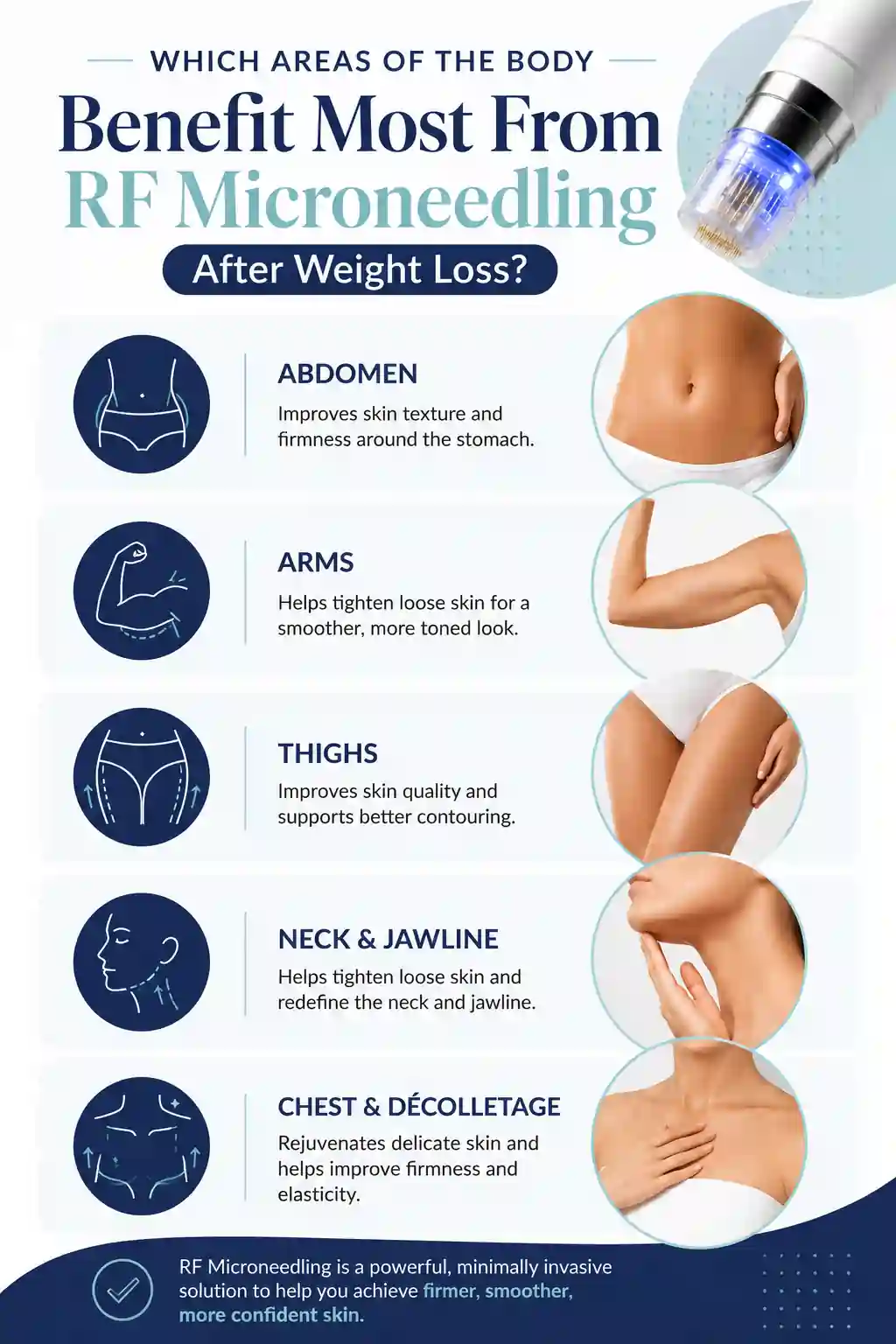 Which Areas of the Body Benefit Most From RF Microneedling After Weight Loss Beaconsfield